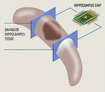 vervangende chip voor Hippocampus