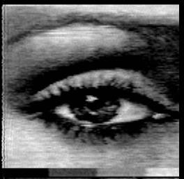 Eyeball Image