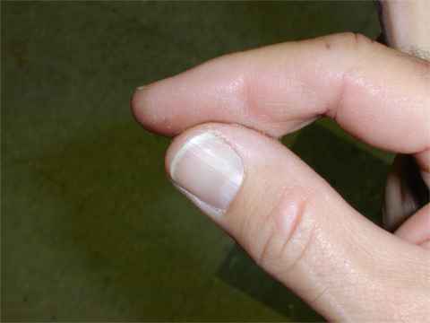 Super glue on sale fingers